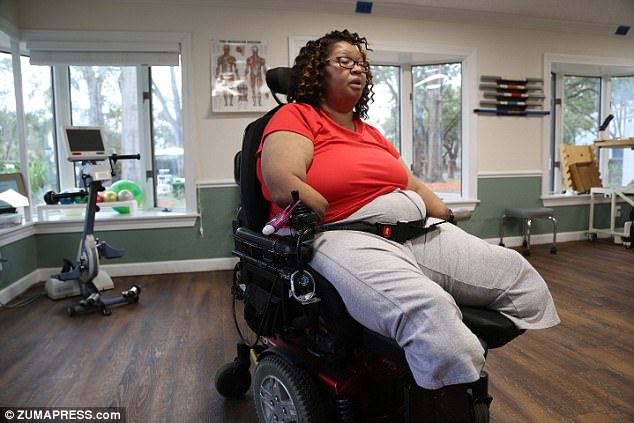 Florida woman lost hands, feet and abs set to win $109m