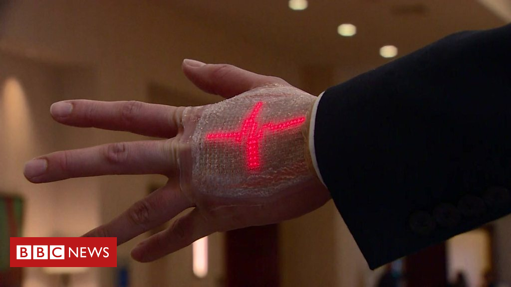 Wearable tech could help stroke patients with recovery