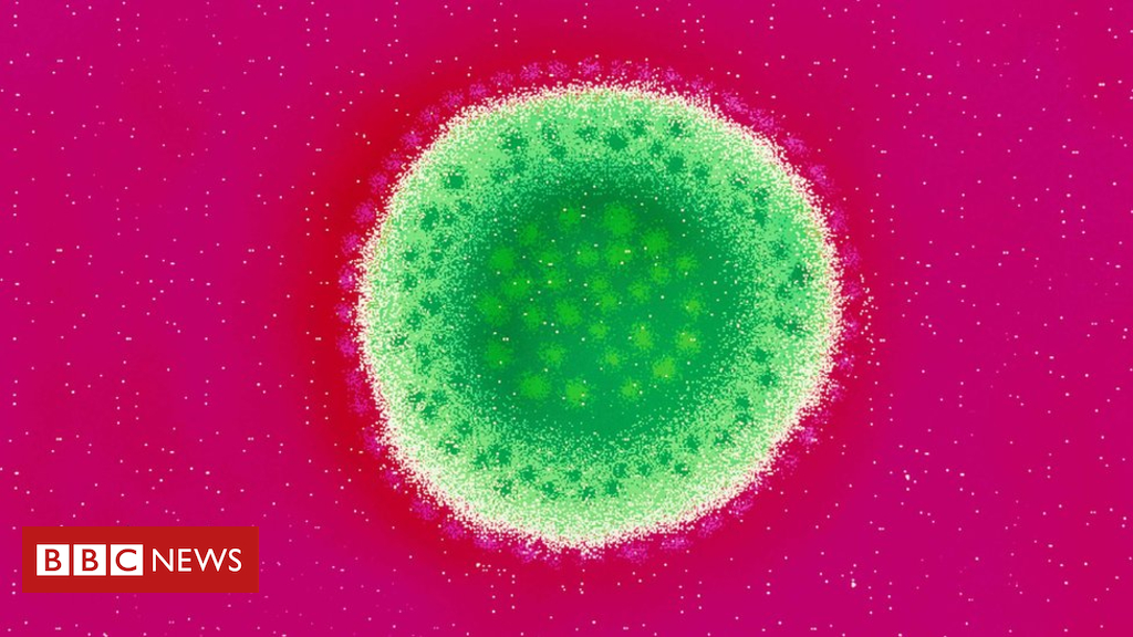 Lassa fever: The killer disease with no vaccine