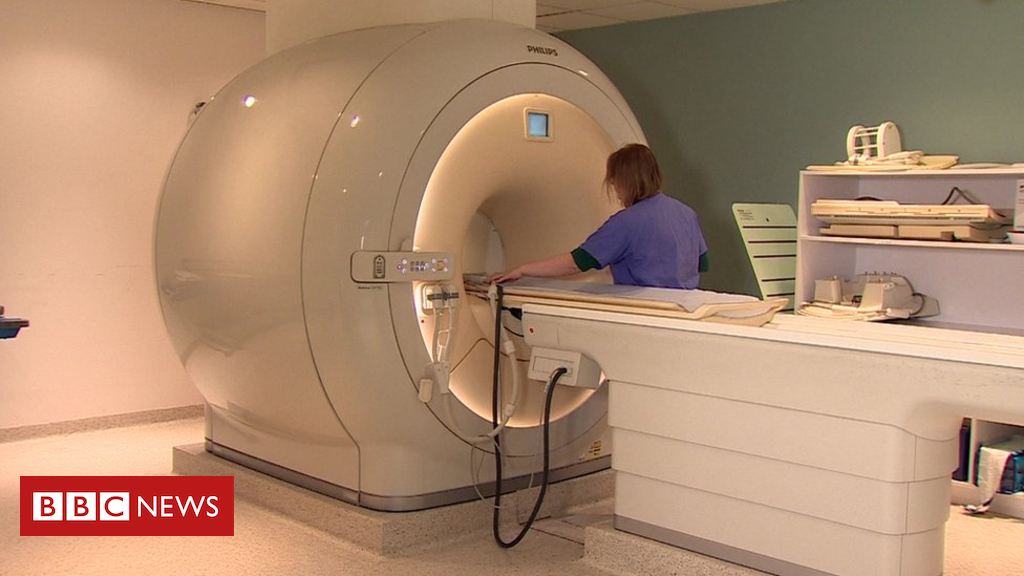 Prostate test ‘breakthrough’ in NHS trial