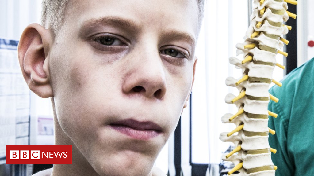 Hospital backlog: The boy who waited 47 weeks for spine surgery