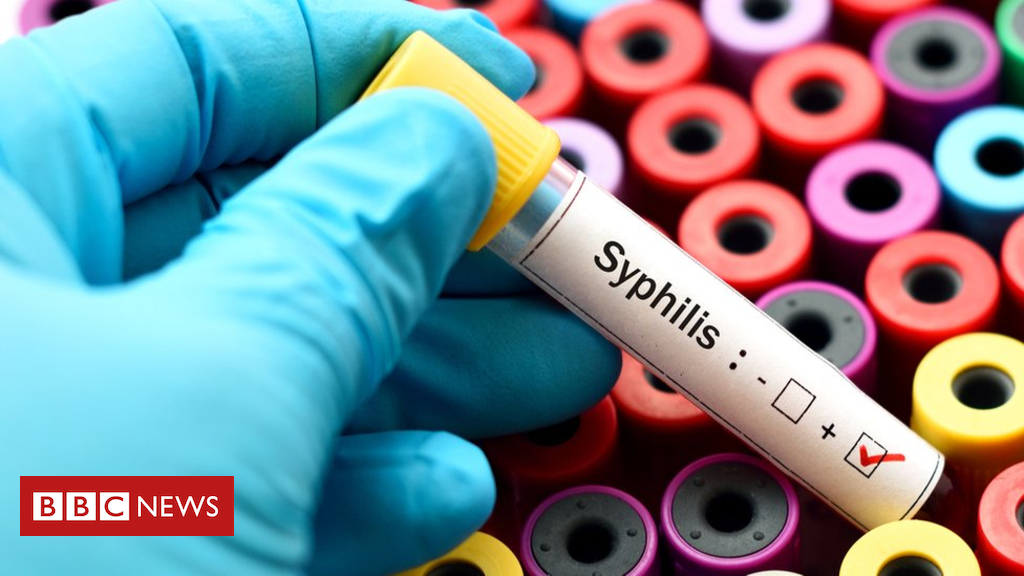 STIs: Why is syphilis is on the rise?