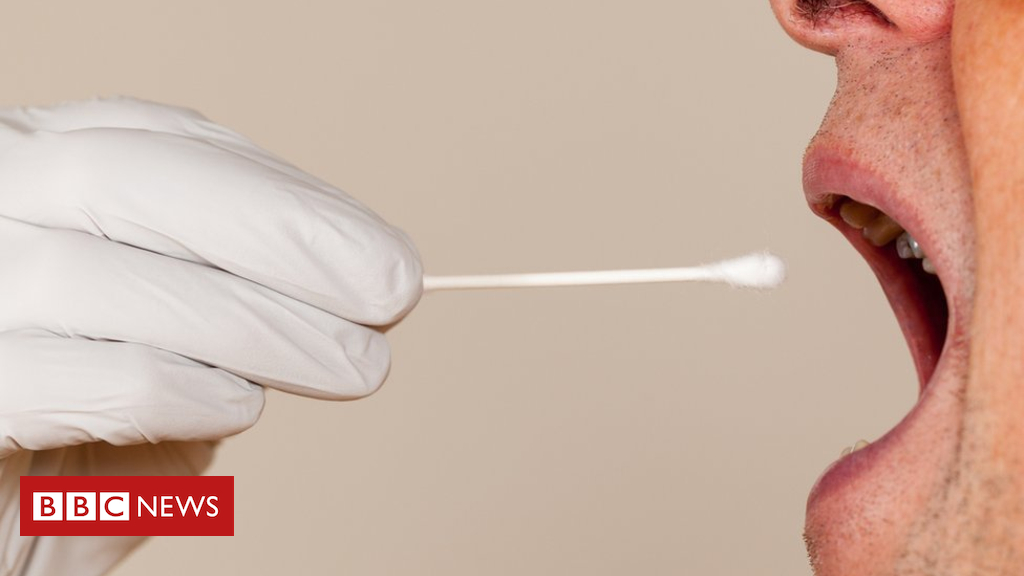 Prostate cancer spit test is trialled