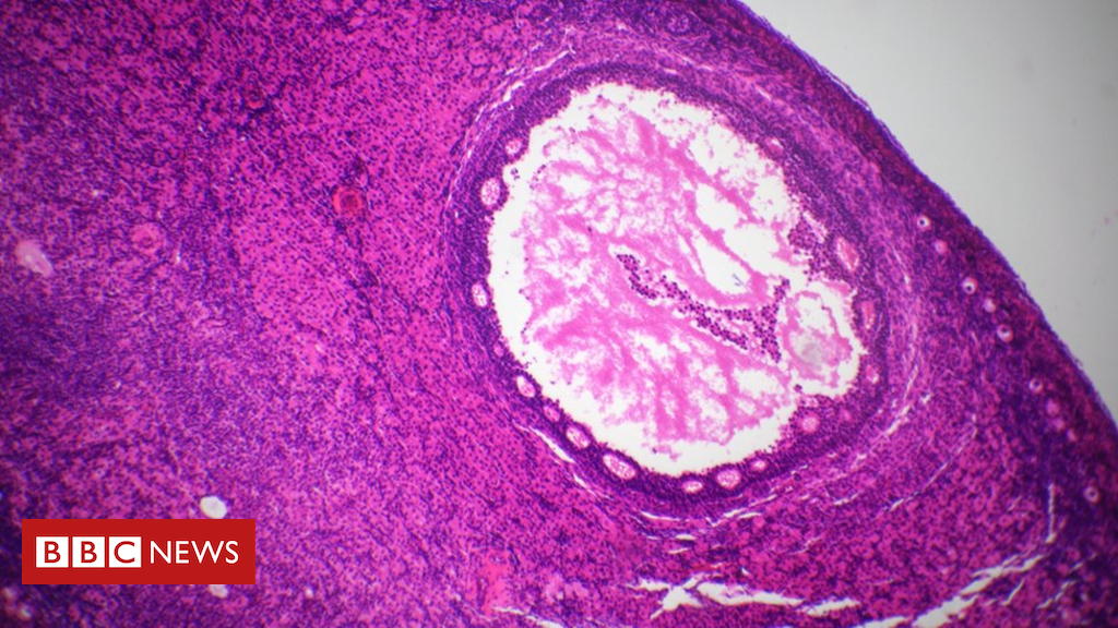 Artificial ovary fertility treatment developed by scientists