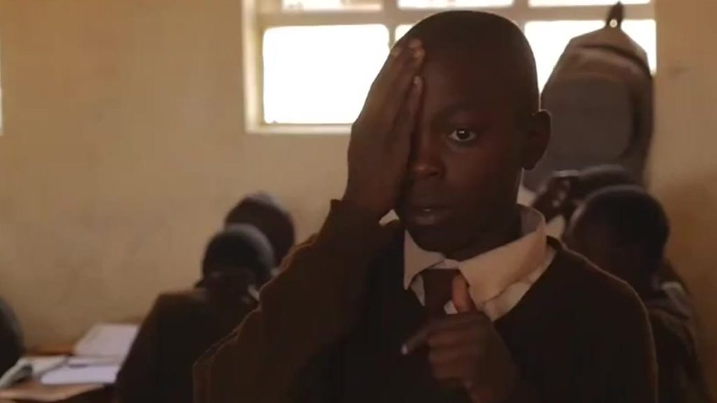 The eye doctor who could not see the stars