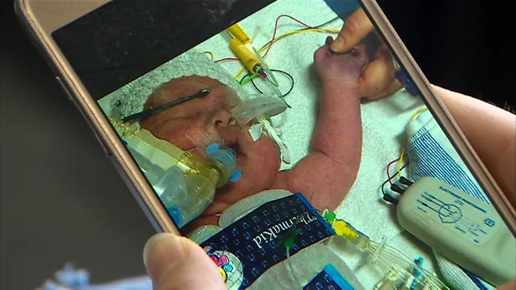 Shropshire baby and mother maternity deaths review widened