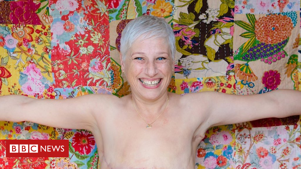Why I’m happy ‘living flat’ after breast cancer