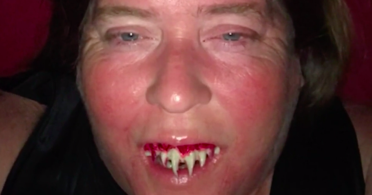 Alabama Woman Is Frightened After Zombie Teeth Get Stuck In Her Mouth