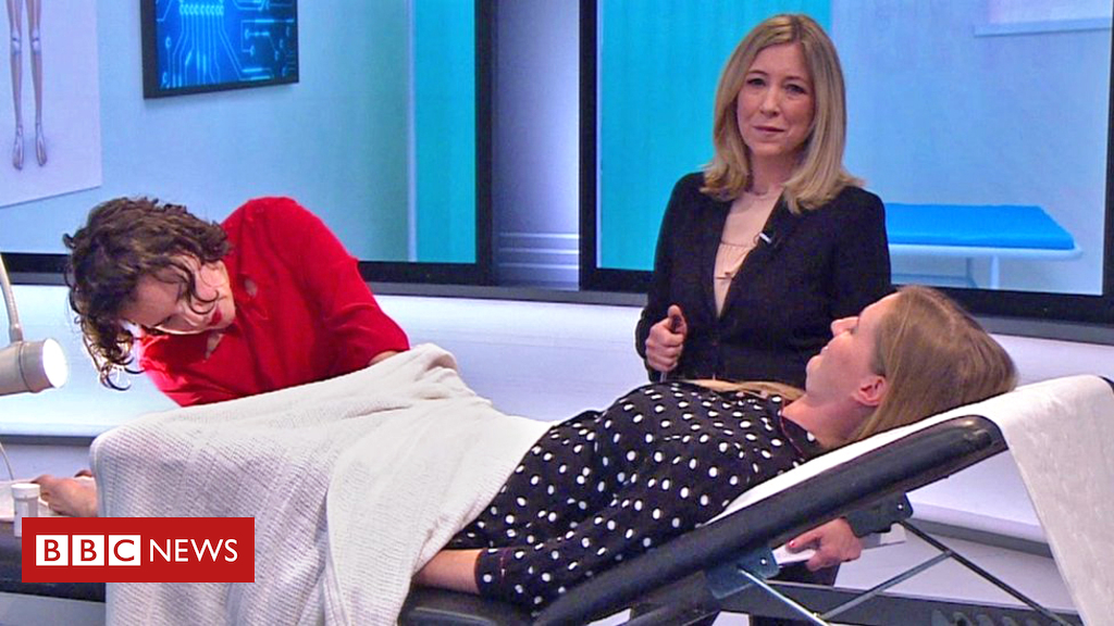 Cervical smear: The 30 second test that could save your life