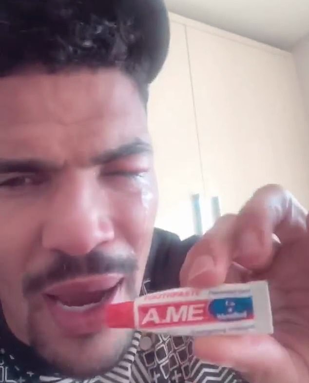 Anthony Ogogo puts toothpaste in his eye instead of special ointment straight after operation