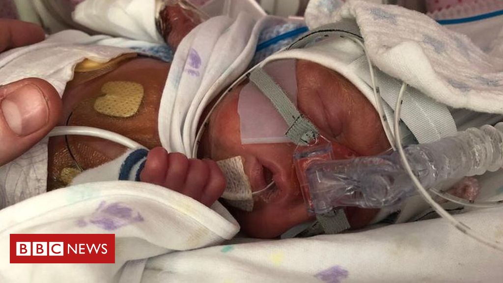Parents of sick babies need more leave, charity says