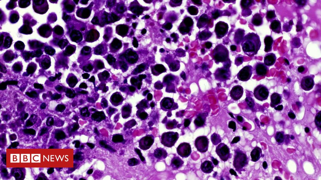 Cancer patient scans cancelled over equipment problems