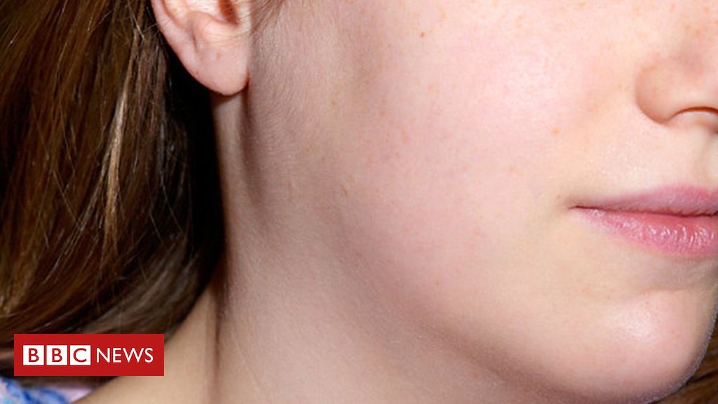 Mumps – is it the forgotten disease?