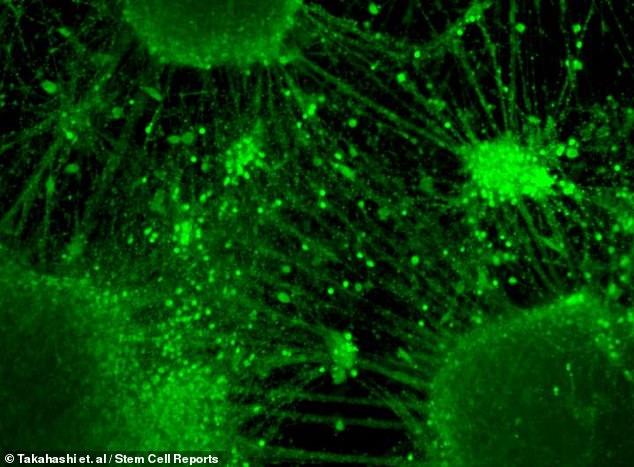 Scientists observe neural activity in lab-grown mini-BRAINS