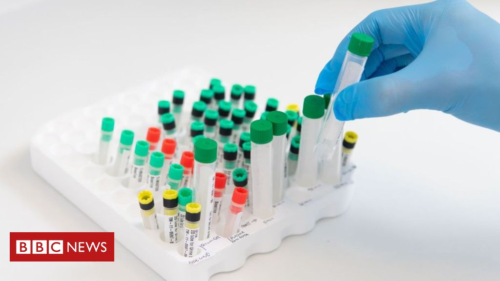 Essex Strep A outbreak: Twelve people dead