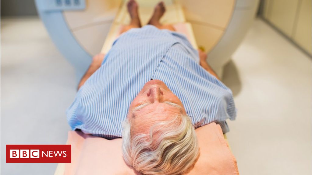 ‘Revolutionary’ drug for prostate cancer