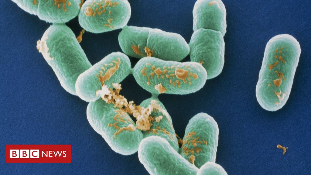 Derby coroner confirms man’s listeria death