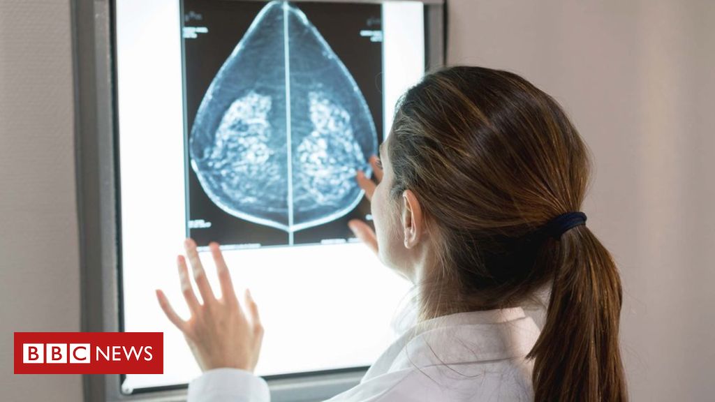 Breast cancer: Call for genetic screening for all