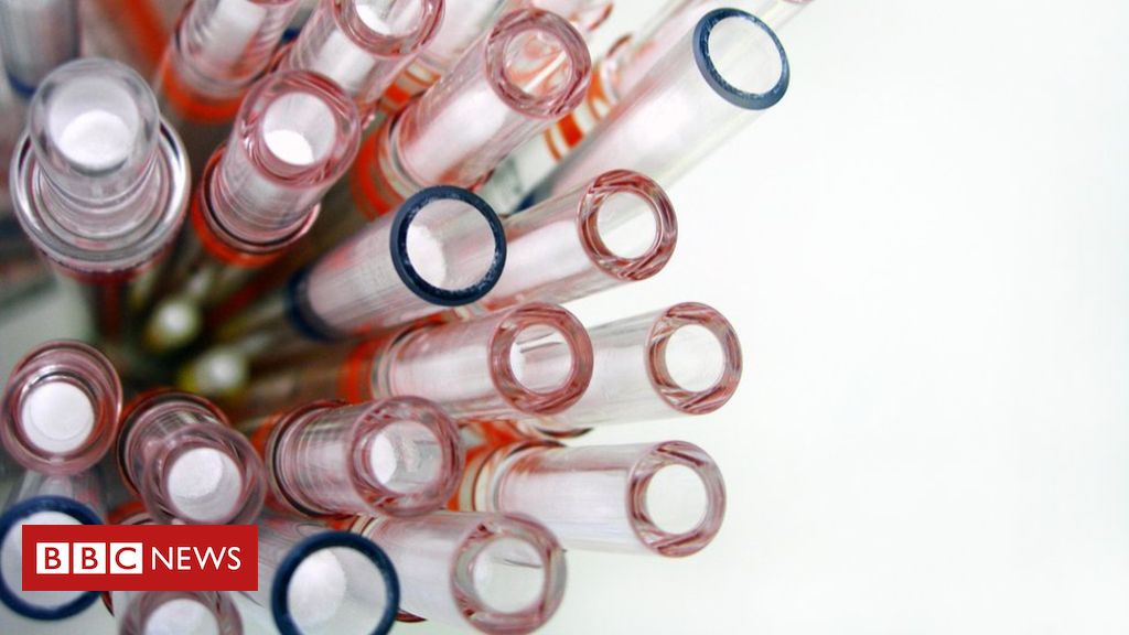 Genetic tests: Experts urge caution over home testing