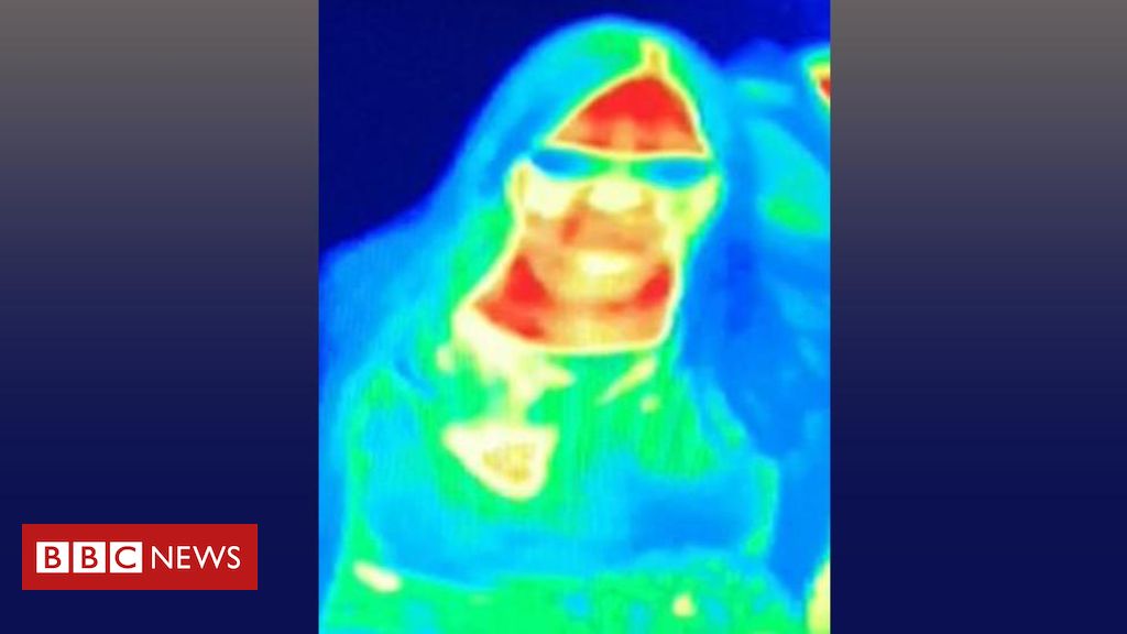Breast cancer detected by thermal imaging scan in Edinburgh