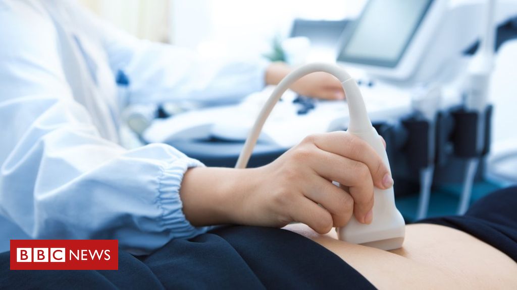 Portuguese doctor suspended after baby born without a face