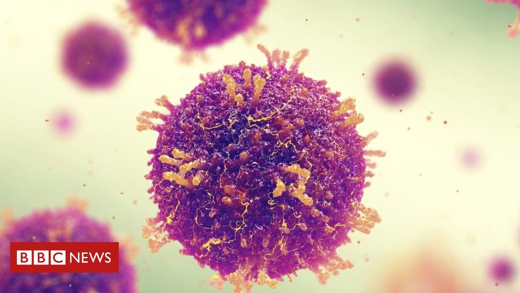 Measles makes body ‘forget’ how to fight infection