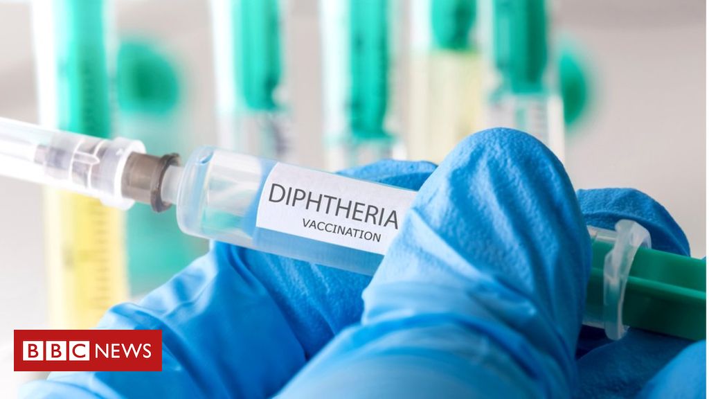 Two cases of deadly diphtheria detected in Lothian area