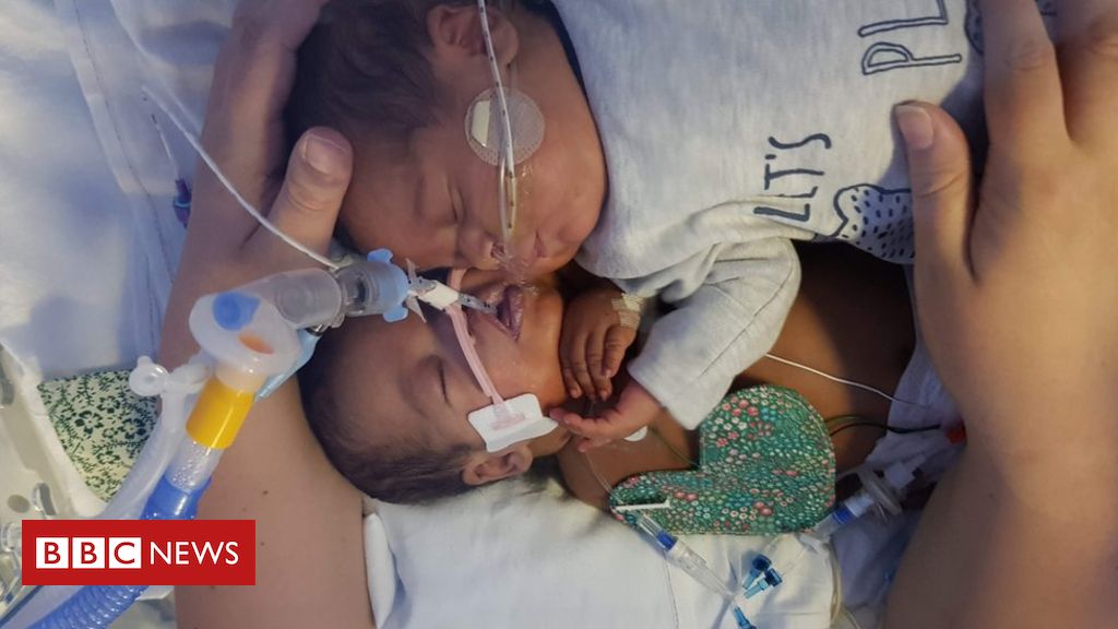 Premature baby’s cuddle ‘saved twin brother’s life’