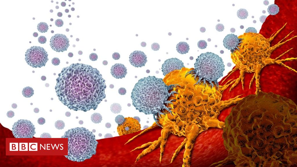 Immunotherapy offers hope for men with prostate cancer