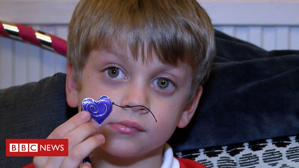 Boy’s rare eye cancer spotted in photograph