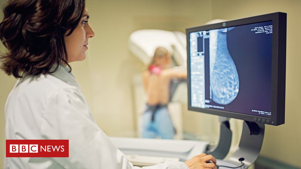 Drug that prevents half of breast cancers carries on working