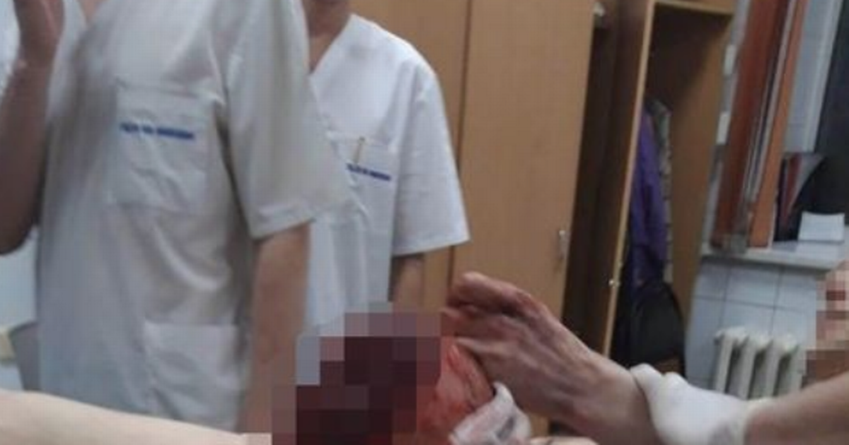 Man high on ‘zombie drug’ Spice saws off own leg and is left with bloodied stump