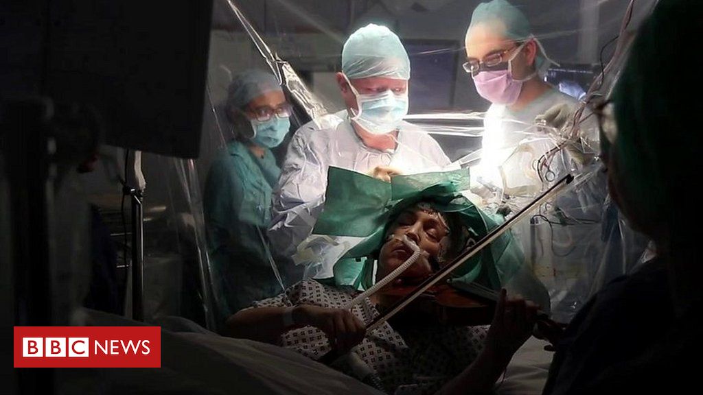 Patient plays violin during her brain surgery