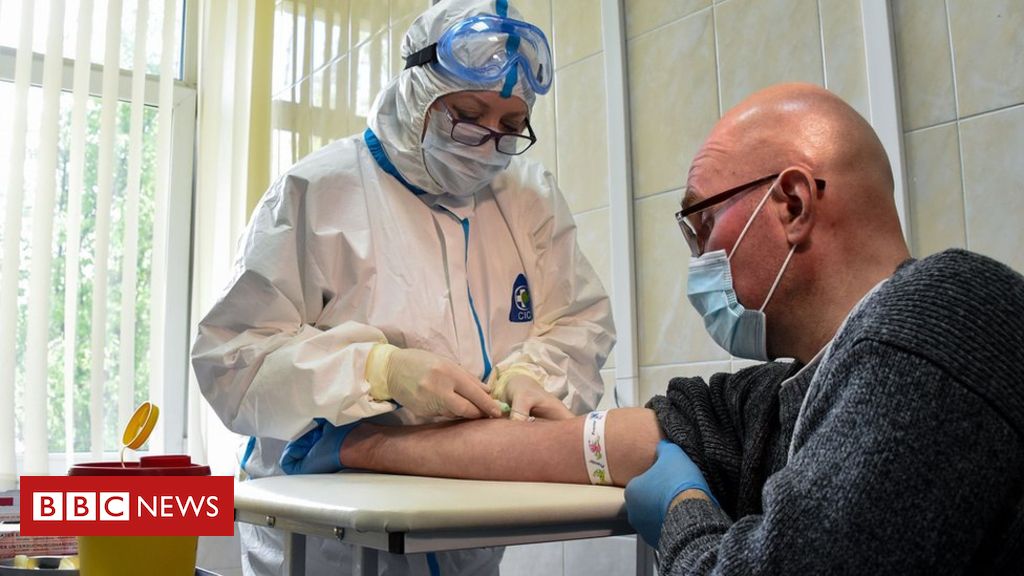 Coronavirus: NHS England official cautions against buying antibody tests