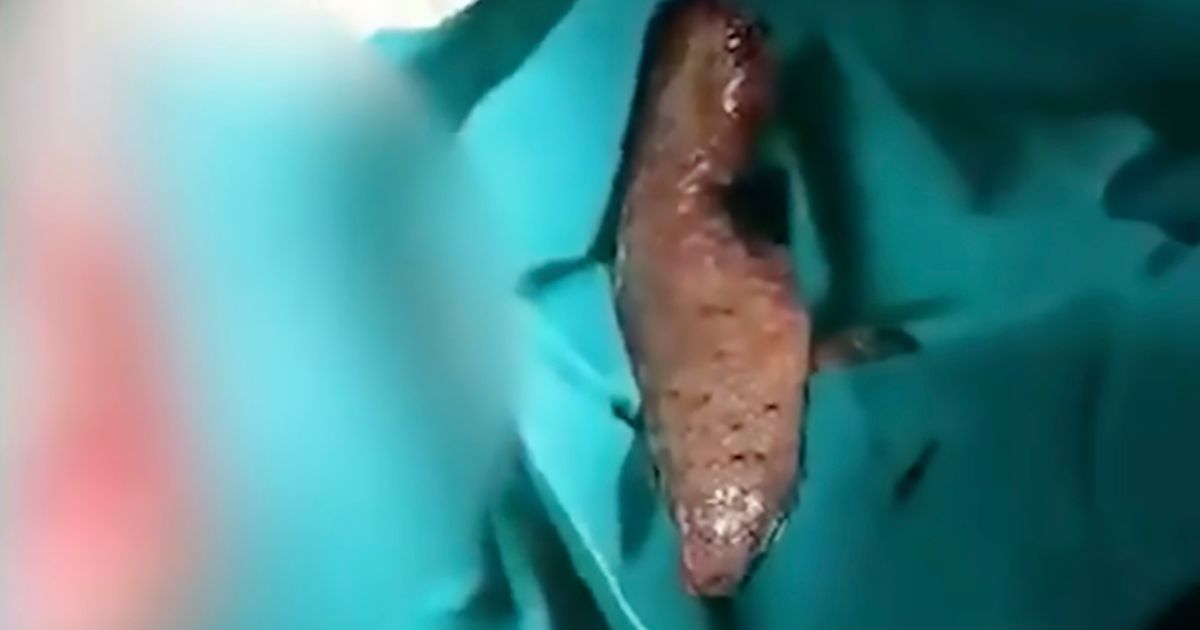 Man found with dead fish up his bum claims he ‘accidentally sat on it’