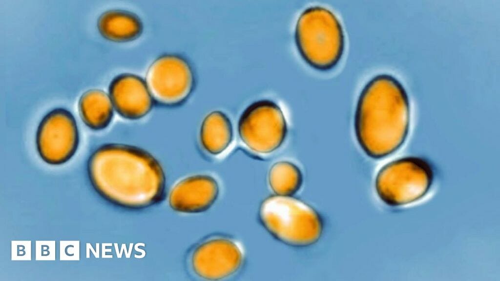 Candida auris: What is the deadly fungus sweeping through US hospitals?