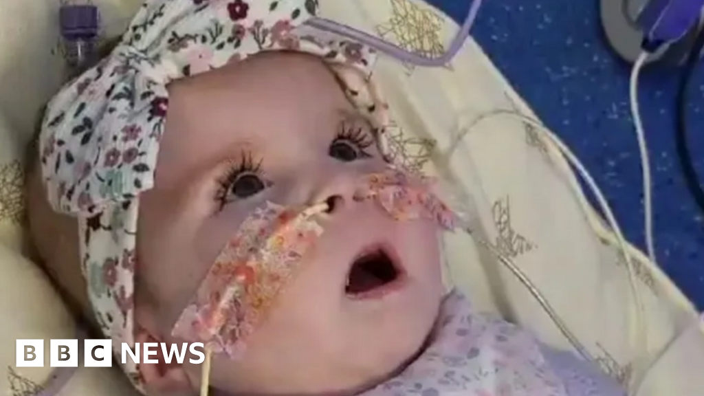 Judge to decide on ending critically ill baby girl's life support