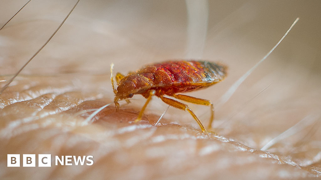 Why do we itch when reading about bedbugs?