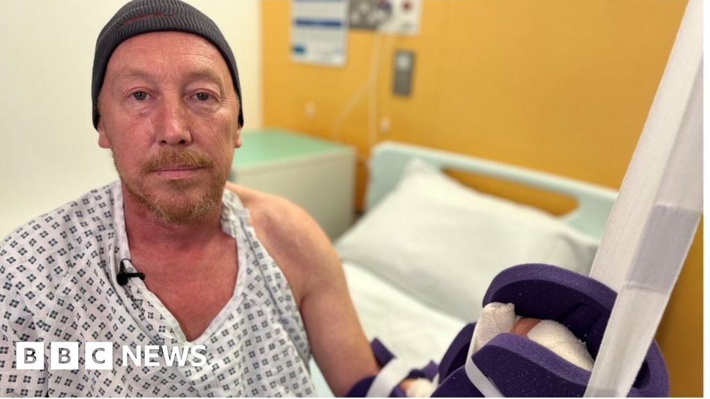 Dog attacks: Victims double since pandemic, surgeon says