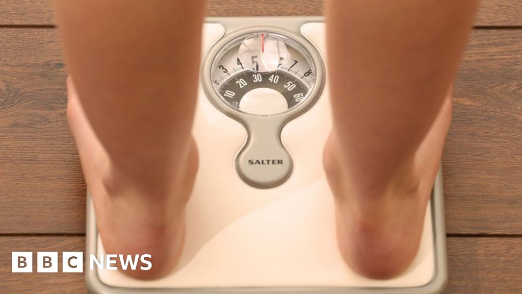 Child obesity in pandemic could have lifelong effects, study says