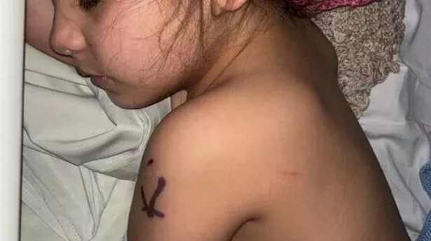 Girl, 4, rushed to hospital with puncture wounds and large gash after dog attack