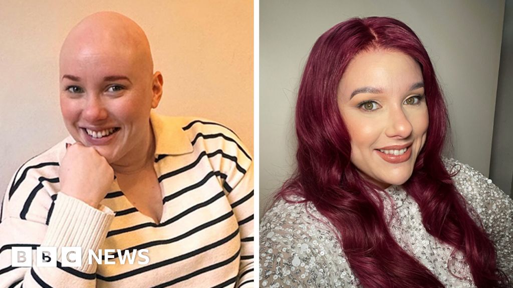 'There is no right or wrong way to have alopecia'