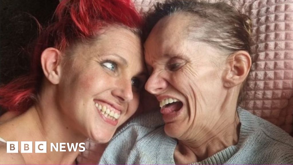 New hope for sisters trapped in their bodies