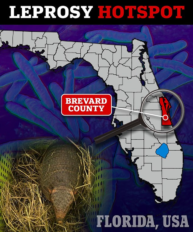 Warning as Florida becomes LEPROSY hotspot of the US – and an unusual animal may be to blame
