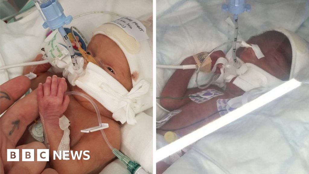 Babies died after London hospital’s neglect – inquest jury