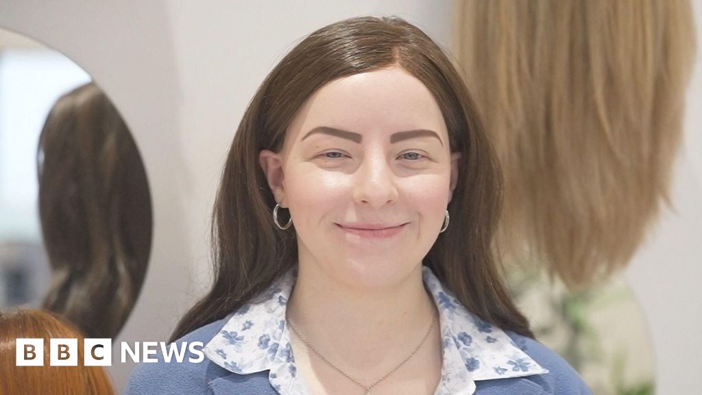 Alopecia: New NHS hair loss drug ‘could make life so much easier’