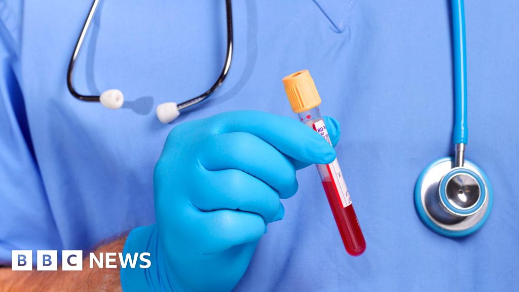 UK authorities on lookout for Lassa fever cases