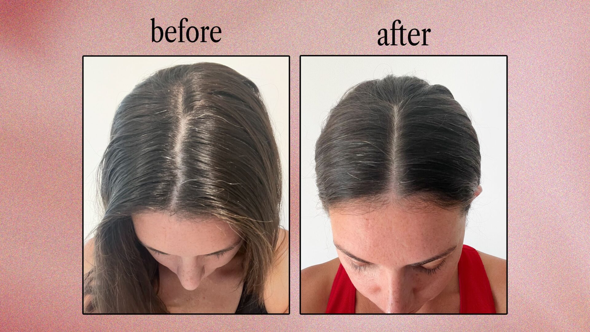 11 Best Shampoos for Dry Scalp 2025, According to Dermatologists