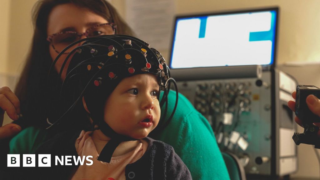 The pioneering child development study monitoring babies’ brains