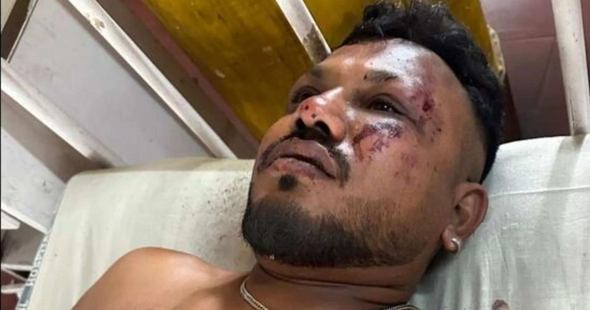 Small detail in Brit Air India plane crash survivor’s memory could solve mystery